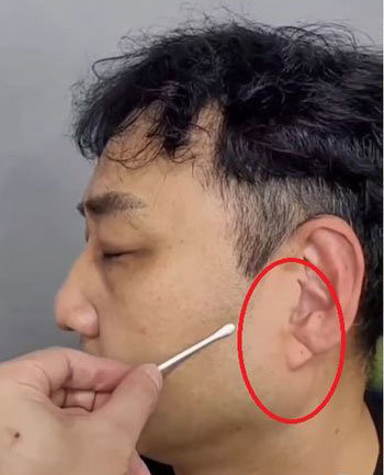 김수용의 귓불 주름이 심근경색 전조 증상이라는 추측에 대해 흉부외과 유재석 교수가 “노화 현상일 뿐 의학적 인과관계는 단정할 수 없다”고 밝혔다. 김수용 인스타그램 캡처