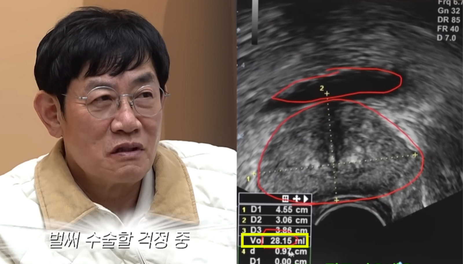 코미디언 이경규가 전립선비대증 진단 사실을 공개했다. 전립선비대증 관리에는 붉은 채소 섭취, 하체운동 등 실질적인 생활 관리가 중요하다. 사진=유튜브 채널 ‘갓경규’