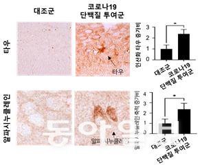 코로나19 바이러스 투여군에서 독성 단백질인 ‘타우’와 ‘알파 시누클레인’이 증가한 사실이 확인됐다. 질병관리청  제공.