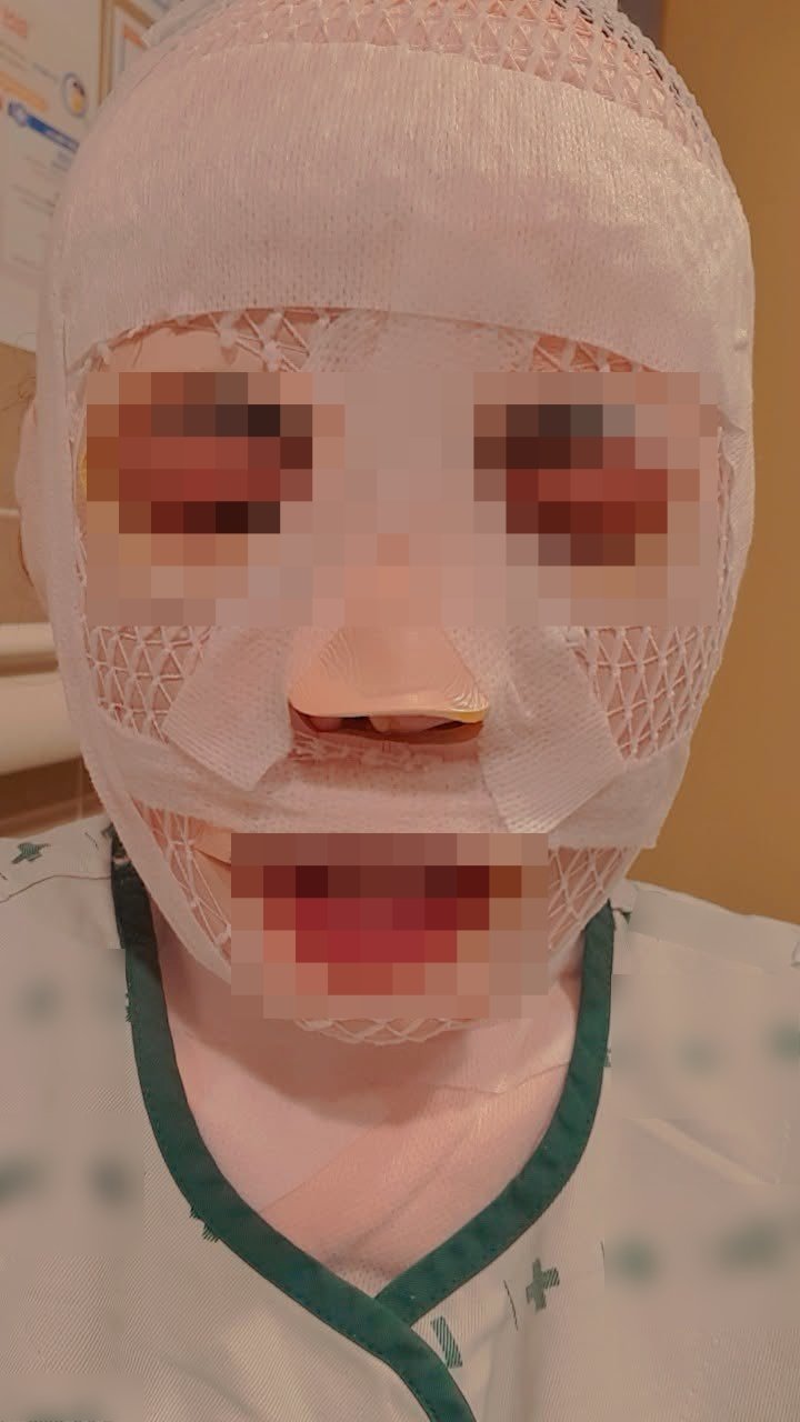 한 태국인 여성이 한국인 남편으로부터 얼굴에 뜨거운 물을 끼얹는 폭행을 당했다고 주장하며 공개한 사진. 페이스북 캡처