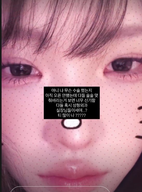 모델 겸 인플루언서 최준희가 성형수술 이후 근황을 공개했다. 수술 내용을 밝히기 전부터 누리꾼들의 추측이 이어지며 회복 과정과 변화에 관심이 쏠리고 있다.ⓒ뉴시스