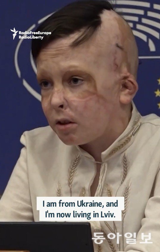 러시아군의 공습으로 크게 다쳐 총 36번의 수술을 받은 11세 우크라이나 소년 로만 올렉시우가 10일(현지 시간) 벨기에 브뤼셀의 유럽의회에서 어머니를 잃은 순간에 대해 증언하고 있다. 그는 2022년 7월 14일 러시아군의 공습때 눈앞에서 어머니를 잃었고, 자신도 심각한 화상을 입었다. 사진 출처 자유유럽방송(RFE/RL) 유튜브