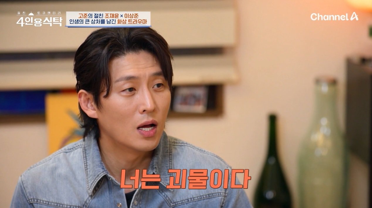 배우 고준이 한 살도 되기 전 전신 화상을 입었던 사고와 유년기 놀림, 고립의 기억을 털어놨다. 그는 연기를 통해 사회를 배웠다고 밝혔다. ⓒ뉴시스