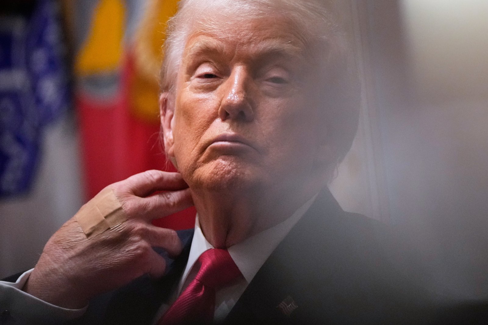 2일(현지 시간) 미국 백악관에서 각료회의를 주재하는 도널드 트럼프 대통령의 오른쪽 손등에 반창고가 붙어 있다. 2025.12.03. 워싱턴=AP/뉴시스