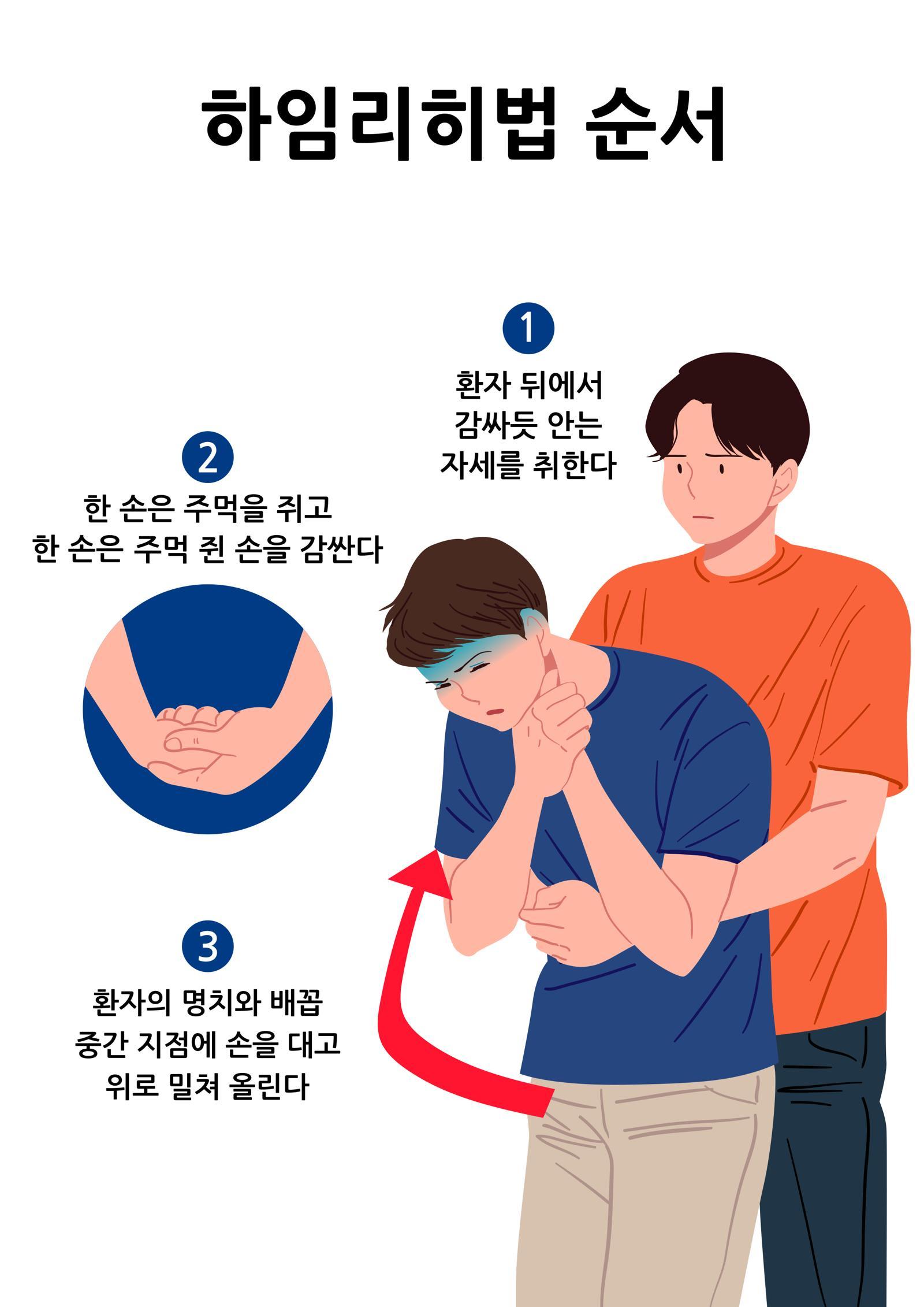 하임리히법 응급처치 방법을 설명한 이미지. 게티이미지뱅크