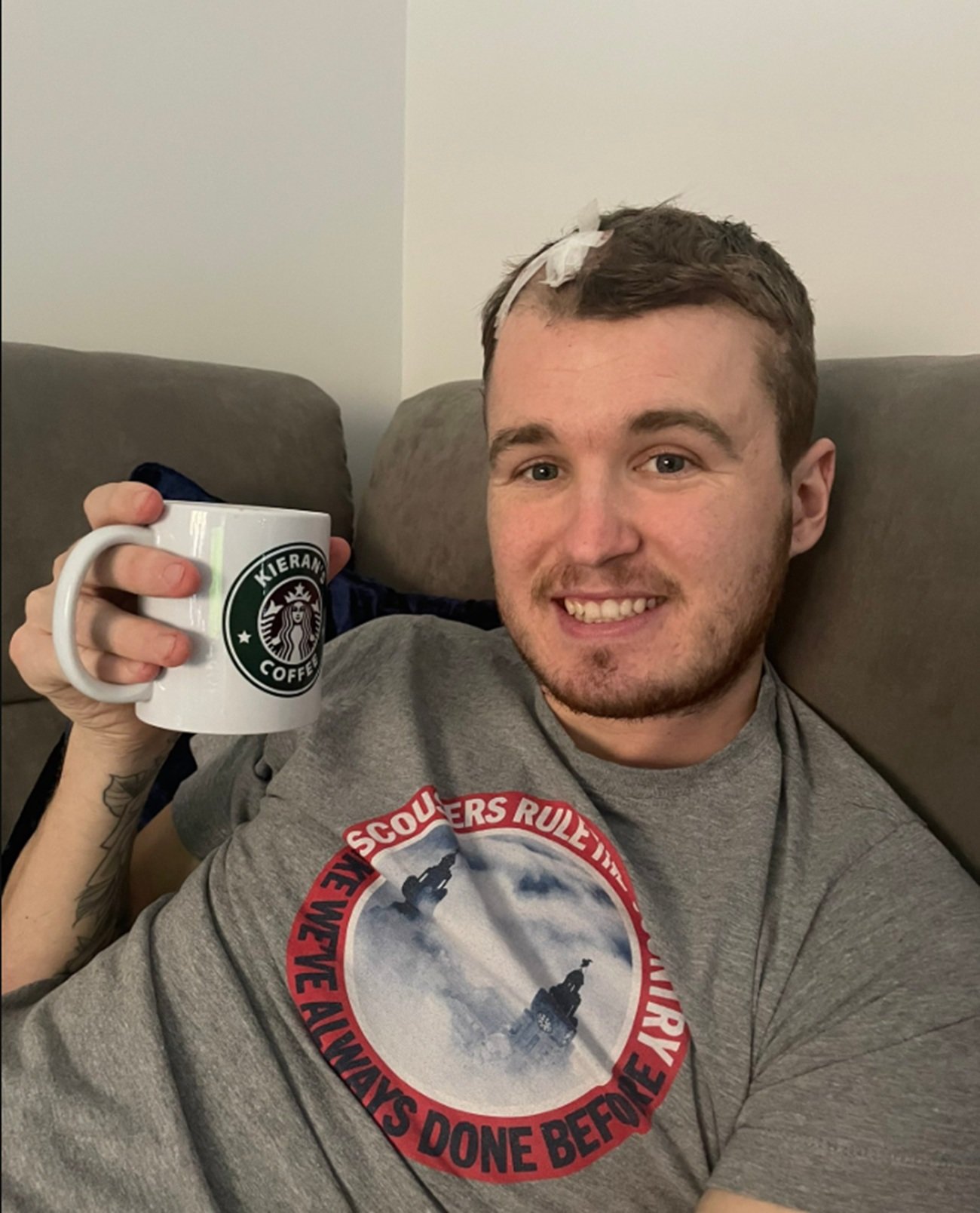 키어런 싱글러의 2023년 모습. 초기 증상이 감기와 유사해 대수롭지 않게 여겼으나, 이후 증상이 악화되며 뇌종양 진단을 받았다. @Abbie Henstock X 갈무리