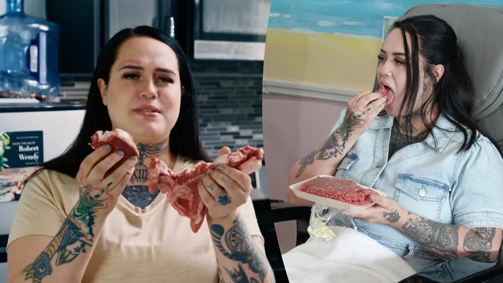 피 뚝뚝 생고기 매일 먹은 美여성…의료진 “만성 감염으로 항생제 안들어”