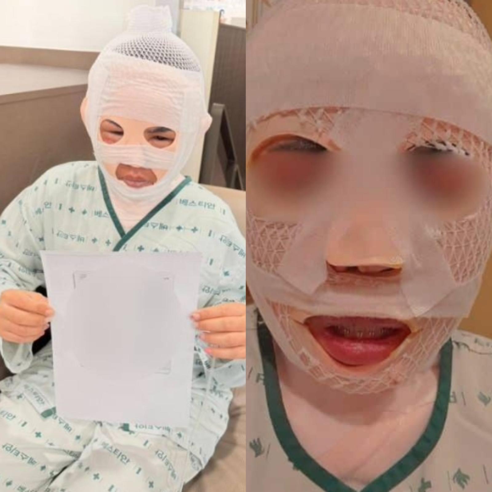 피해 여성. 피해 여성 측은 남편의 고의 범행을 주장하고 있으며, 남성은 특수상해 혐의로 기소됐다. ⓒ뉴시스