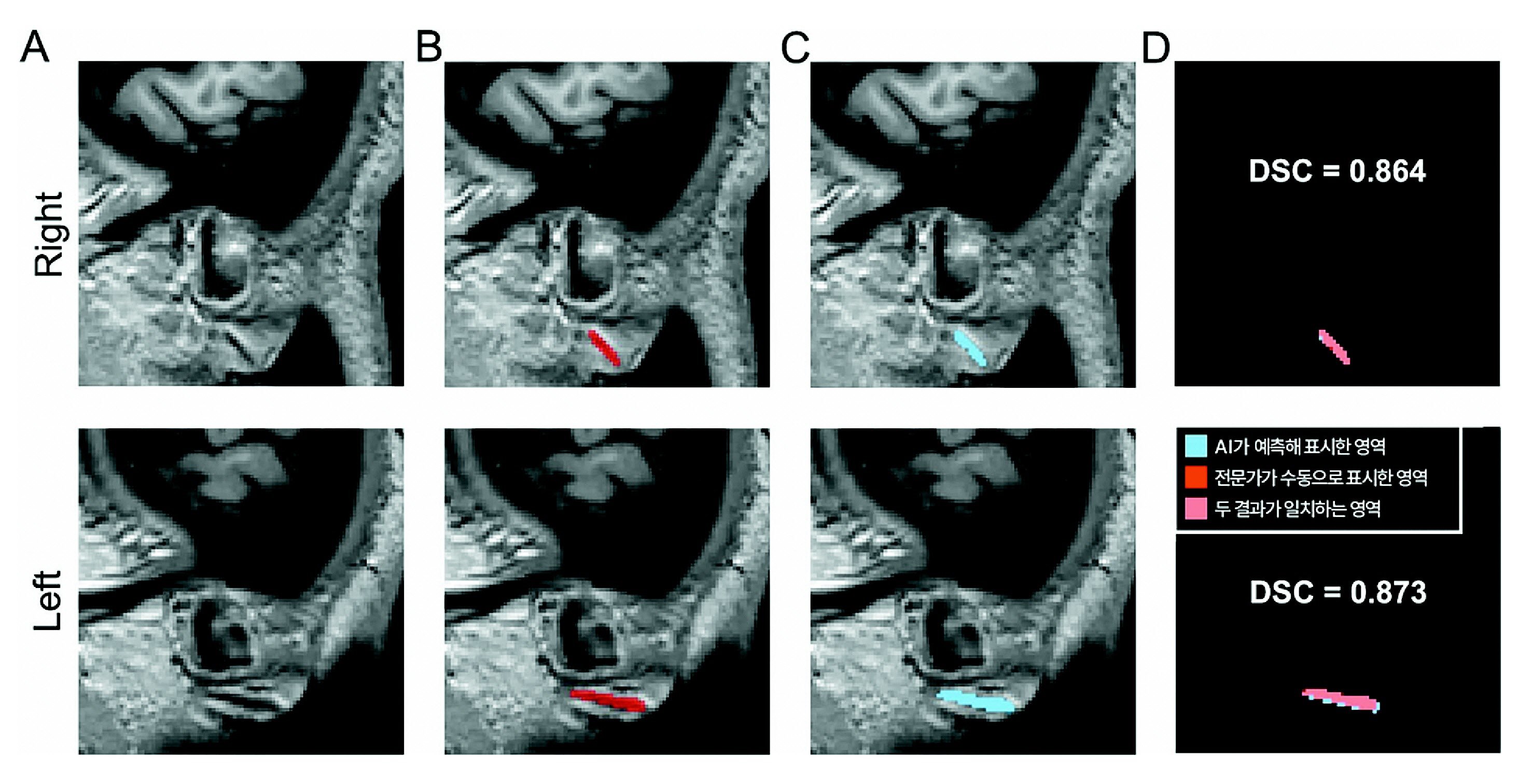 3차원 원본 이미지(A)를 토대로 전문가가 수동으로 직접 표시한 주름(B)과 AI가 예측해 자동으로 표시한 영역(C).