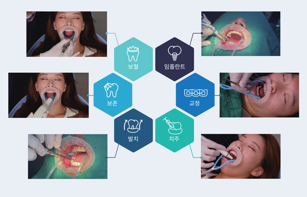히포 D의 각종 이용 사례 / 출처=네오덱스