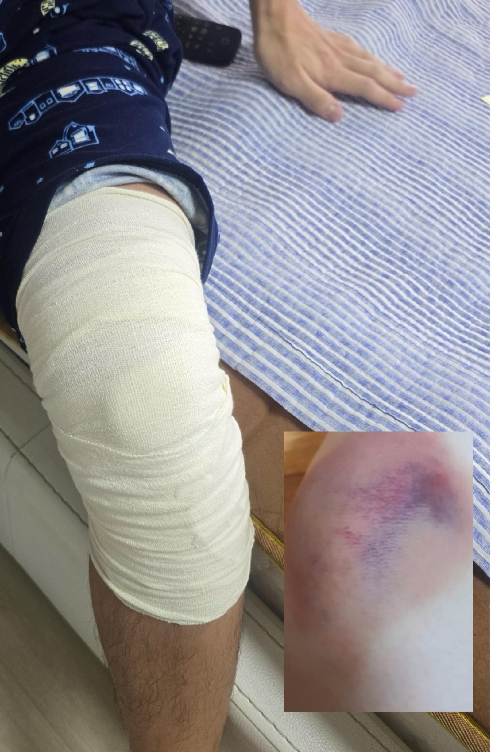 무릎 인대 손상 등 6주의 치료를 요하는 진단을 받은 동탄 고등학교 학폭 피해자.ⓒ 뉴스1