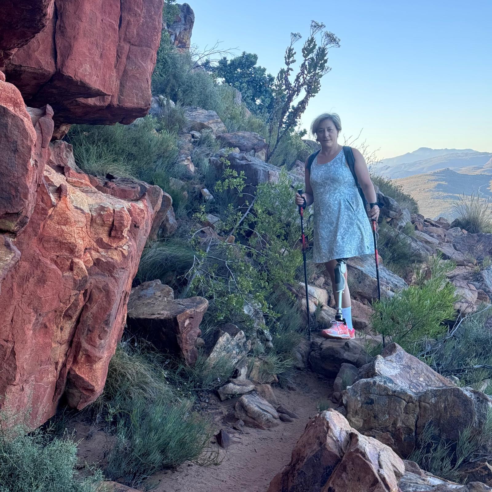 “단순 감기인 줄 알았는데”…‘살 파먹는 병’으로 한쪽 다리 절단