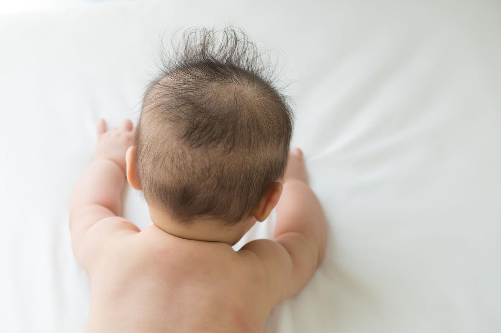 ‘예쁜 두상’ 교정헬멧 쓰는 아이들…“생활 습관 더 중요”