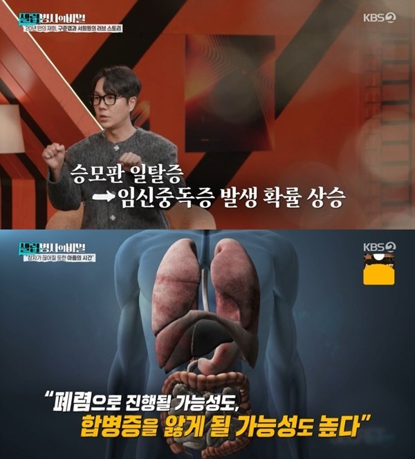 KBS 2TV ‘셀럽병사의 비밀’ 캡처