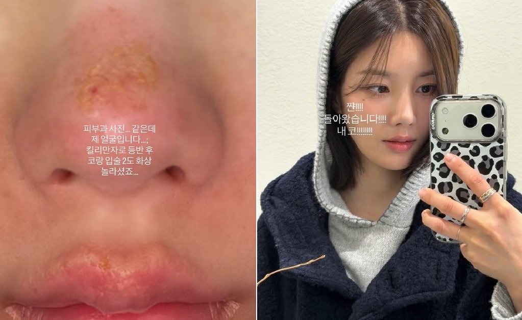 권은비 SNS 갈무리