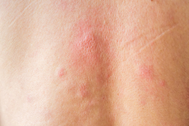 김승수 “뾰루지인 줄 알았는데…사망 직전까지 갔다” 무슨일?