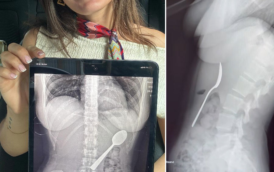 레이미아멜링크스 인스타그램 갈무리