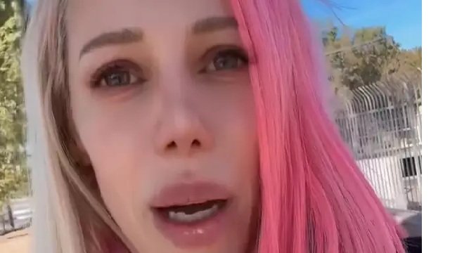 의사 처방 없이 오젬픽을 우회 구입해 1년 복용후 골다공증과 골밀도 감소 부작용을 겪고 있다고 밝힌 미국 가수 에이버리. 인스타그램 캡처.