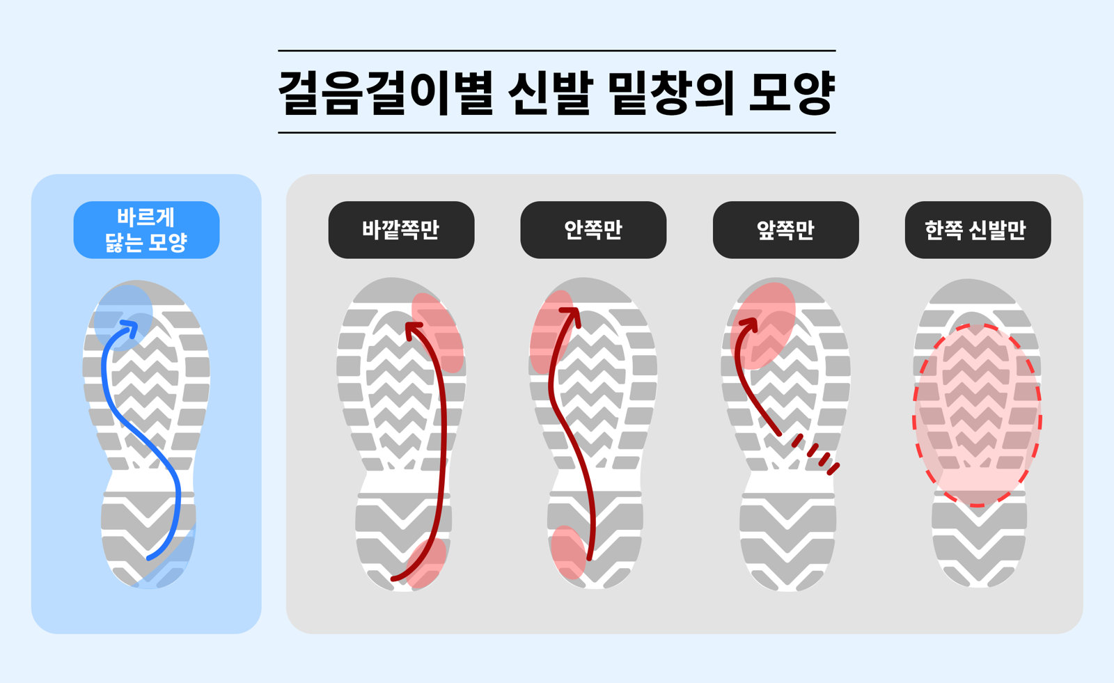 밑창이 닳은 위치를 보면 보행 습관과 체중 분산 상태를 가늠할 수 있고 이는 무릎과 고관절, 발목 등 관절 건강과 밀접하게 연결된다.
제일정형외과병원 제공