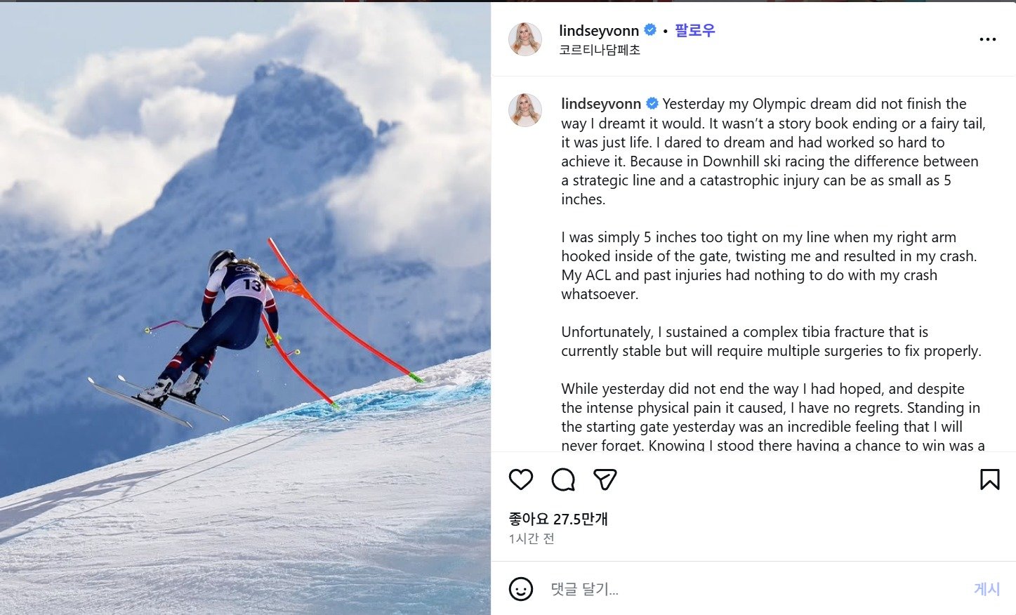 2026 밀라노·코르티나담페초 동계 올림픽에 출전한 알파인스키 선수 린지 본(42·미국)이 부상으로 인한 몸 상태와 심경을 알리는 게시물. 린지본 인스타그램 갈무리