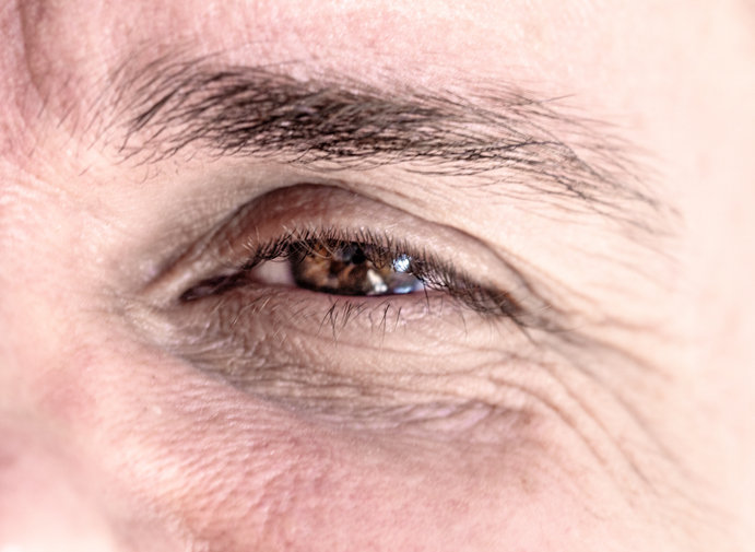 중년의 눈꺼풀 처짐은 시야 확보를 위한 이마 근육 과사용을 유발해 두통과 어깨결림을 일으킨다. 사진=게티이미지뱅크.