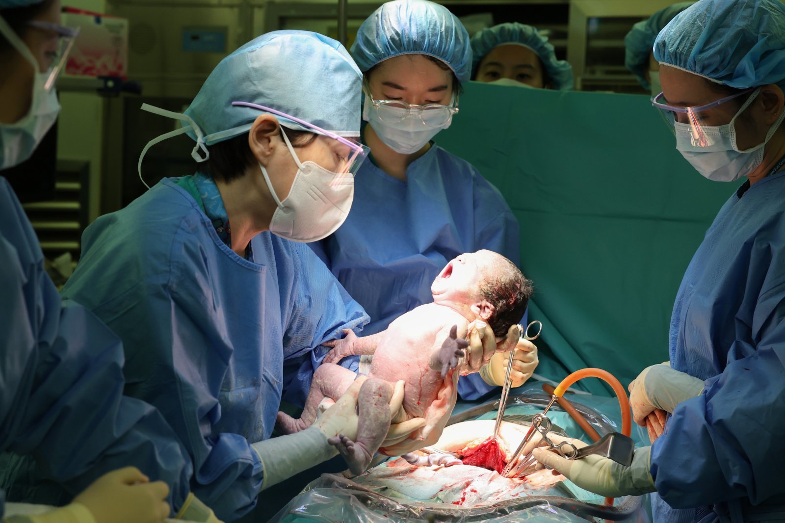 서울아산병원은 고위험군 산모가 60%에 달하는 상황에서 지난 1월 한 달간 329건의 분만을 성공적으로 마쳤다. ⓒ뉴시스