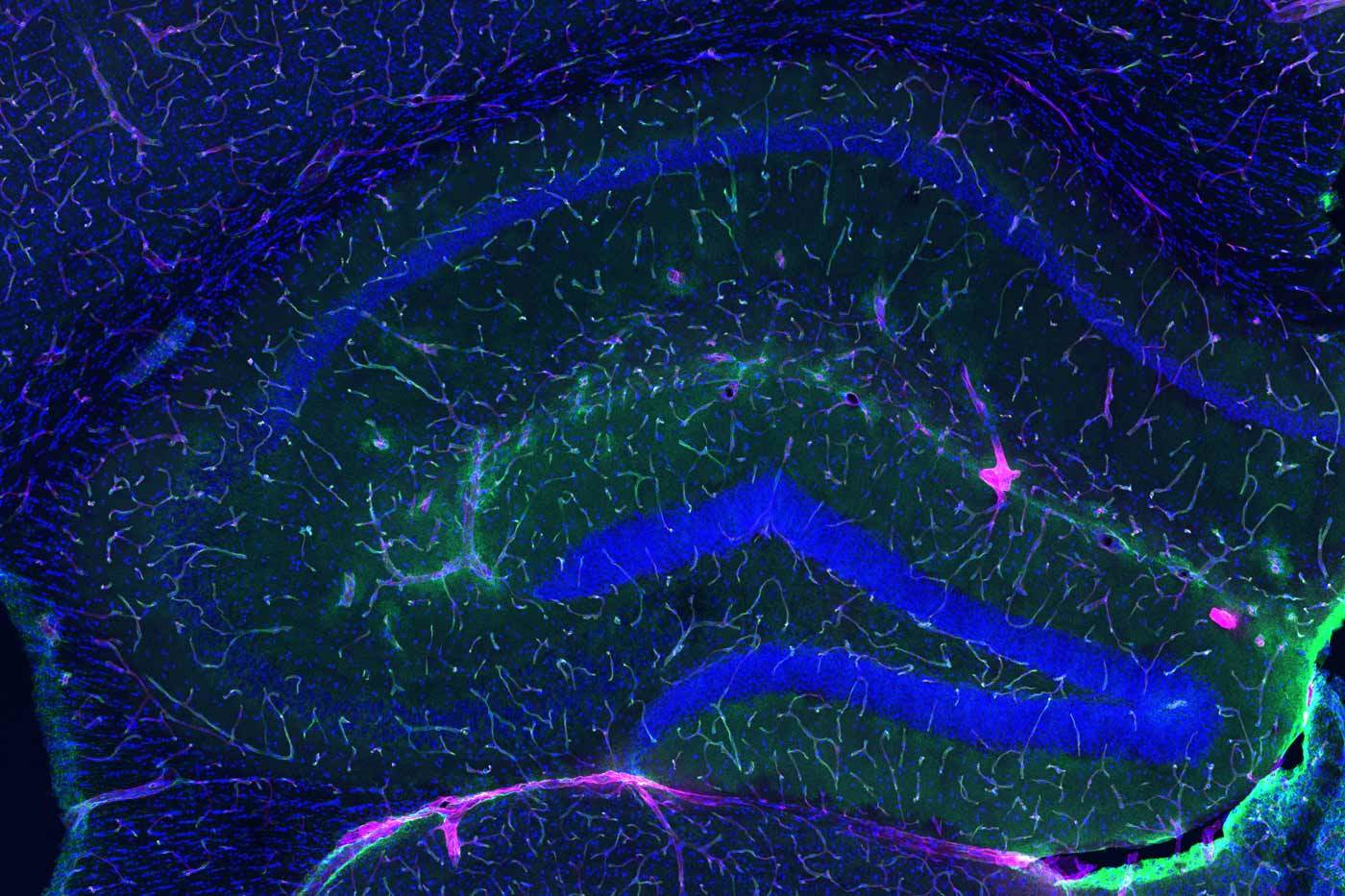 젊은 생쥐의 혈액-뇌 장벽(녹색선)은 주입된 연료(이물질) 대부분이 뇌에 도달하는 것을 막는다. 사울 빌레다 박사 연구실 제공.