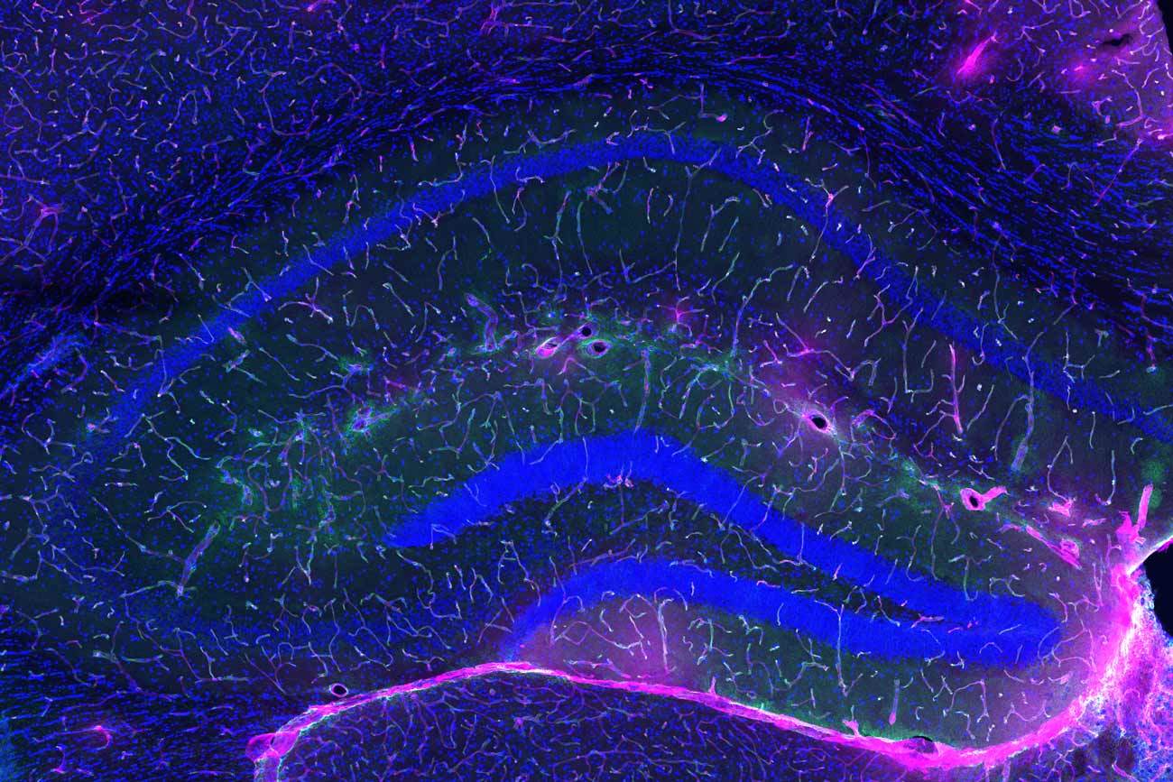 GPLD1으로 치료받은 늙은 생쥐는 혈액-뇌 장벽이 복구되어 뇌로 침투하는 염료의 양이 줄었다. . 사울 빌레다 박사 연구실 제공.