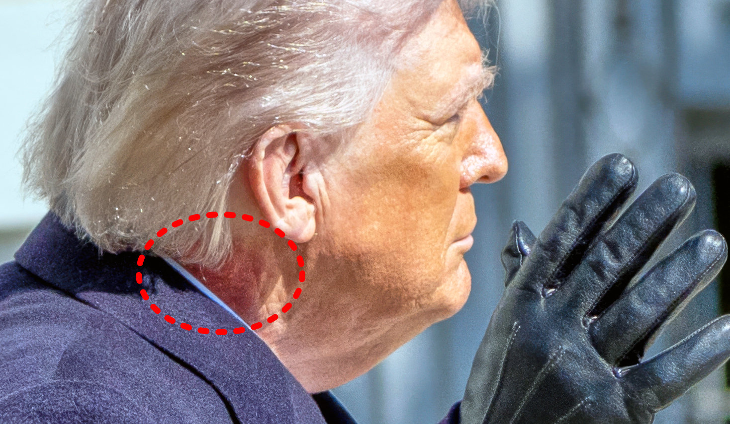 도널드 트럼프 미국 대통령. 최근 그의 오른쪽 목에 붉은 반점이 크게 자리 잡은 것이 포착됐다. AP=뉴시스