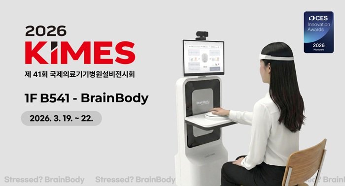 사진제공=우노빈스