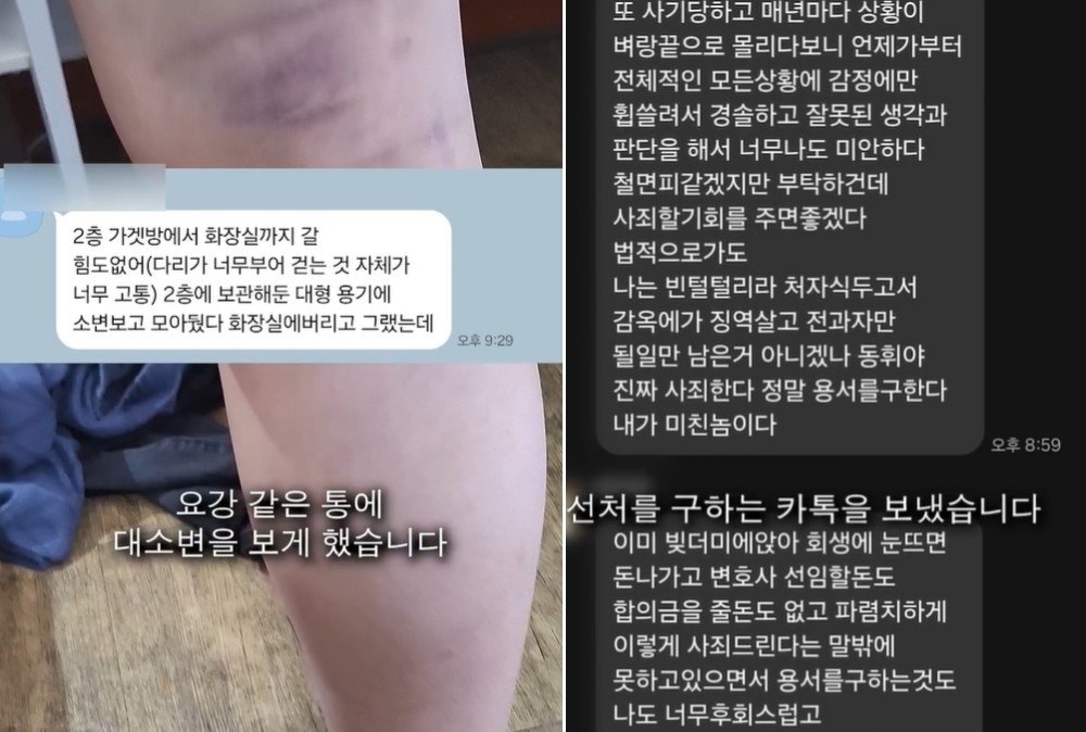 부산의 한 중국집 사장이 직원을 수년간 감금·폭행했다는 주장이 제기됐다. 피해자의 다리가 부은 모습(왼쪽)·사장이 선처를 구하며 보낸 메시지. 스레드 캡처