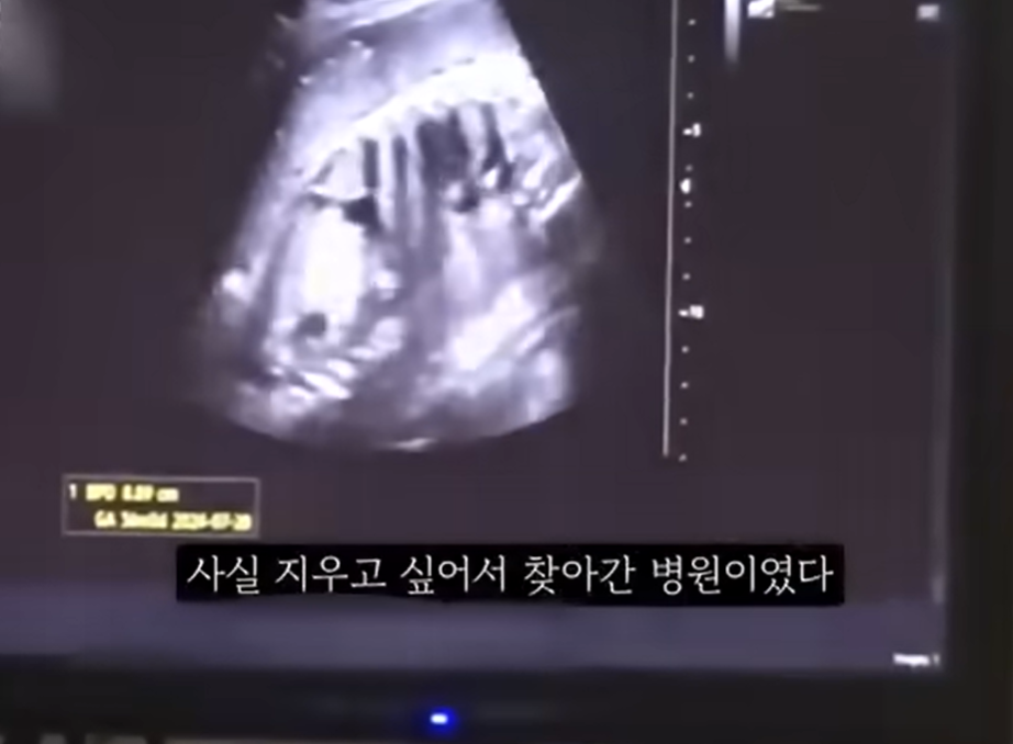 [단독]‘36주 낙태’ 20대女, 50대 교제남이 수술비 내주고 떠났다