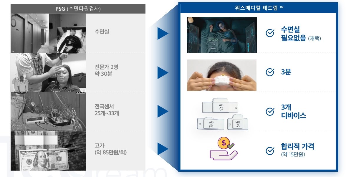 기존 수면다원검사(왼쪽)와 위스메디컬 테드림(오른쪽)의 차이 / 출처=위스메디컬