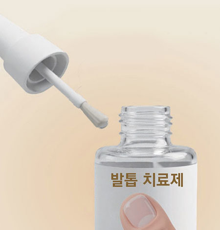 [이진한의 메디컬리포트]발톱무좀, SNS를 점령한 ‘가짜 완치’의 유혹