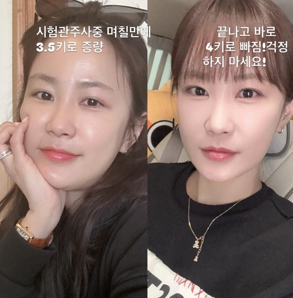 “이래도 되나 싶을 정도”…김지민, 시험관 시술 후 3.5kg 증량