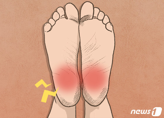 자다 일어나 첫발 뗐는데 “악”…발 부여잡게 만드는 족저근막염
