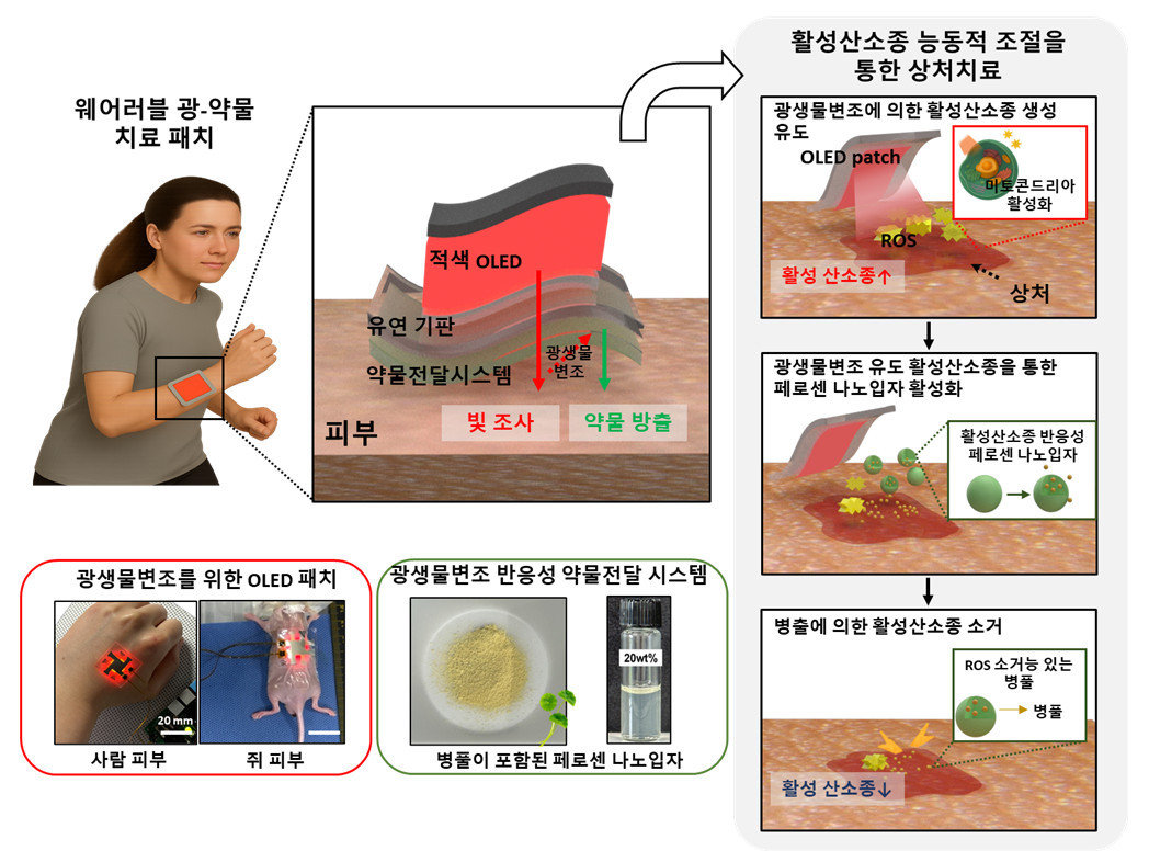 빛으로 상처 치료, 약물도 알아서 조절…스마트 패치 나왔다