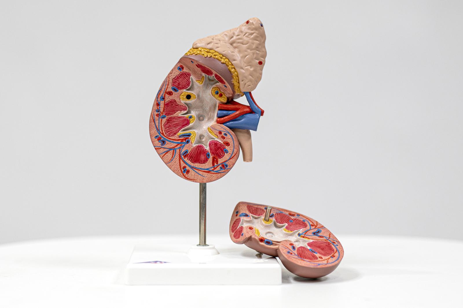 살찌고 지방간 있는 2030, 신장암 위험 2배 이상 높다