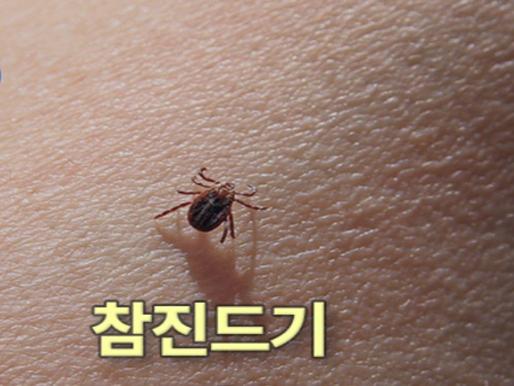 “백신도 약도 없다” 등산 중 ‘이것’ 물렸다간 구토·설사…사망할 수도