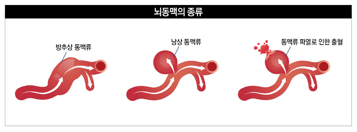 고려대학교의료원 제공