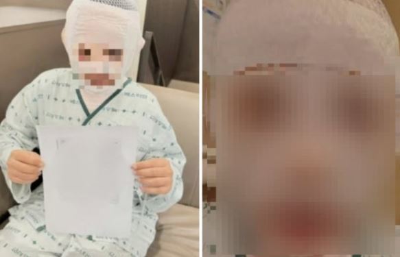 끓는 물 부은 남편 감쌌던 아내, “처벌 원해” 마음 바꿨다