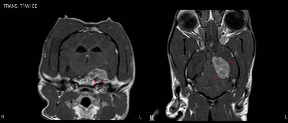 중추신경계이상 MRI 사진
