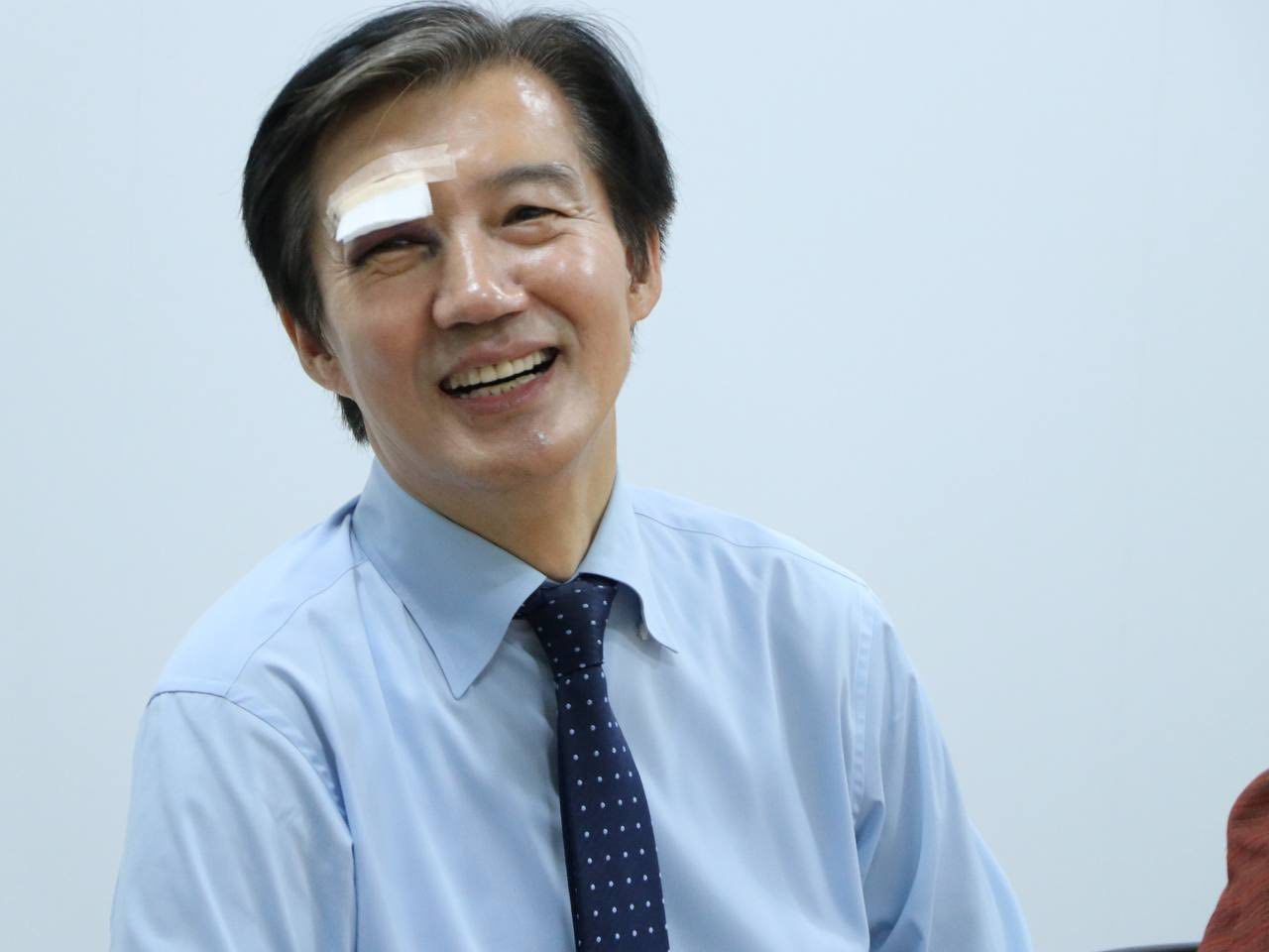조국, 유세중 부상…“눈두덩이 붓고 멍들어”
