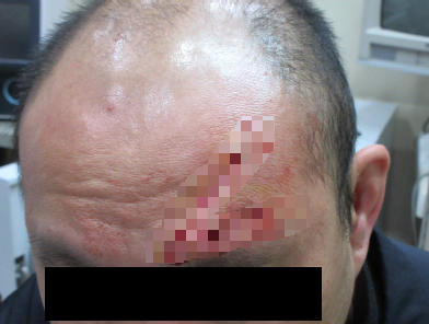 2023년 11월 17일 소란을 일으킨 수용자가 자해를 시도하자 이를 제지하던 교도관이 이마 부위에 상처를 입는 사고가 발생했다. 법무부 교정본부 제공