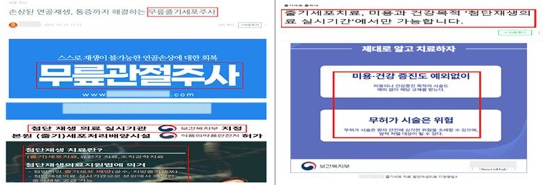 ‘무릎 골관절염 주사’를 첨단재생의료처럼 홍보한 광고 사례. (복지부 제공)