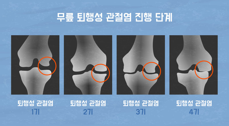 사진=게티이미지뱅크.