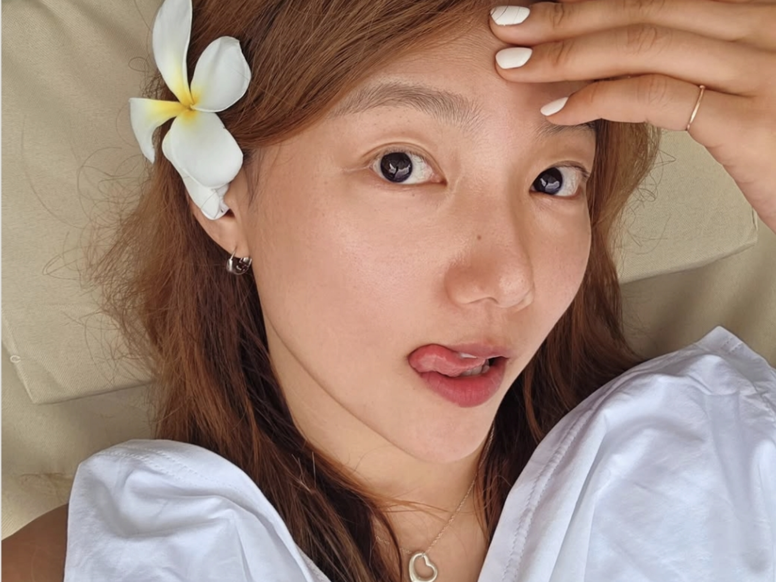 이채영 휴양지서 얼굴 열꽃…무시하면 안되는 ‘햇빛 알레르기’