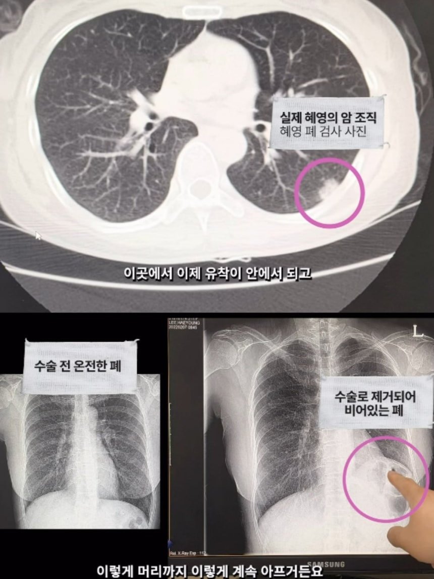 배우 이혜영이 10일 폐암 투병 생활을 공개했다. 인스타그램 캡처
