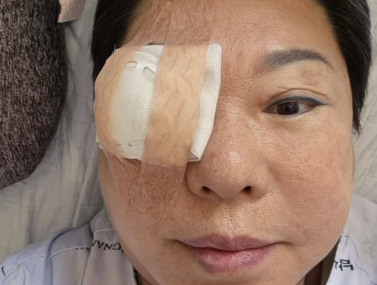 양희은 “각막이식 수술…난 아파야만 쉬는 여자인가”