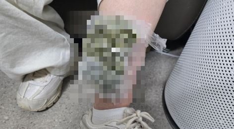 마약류 ‘꿀꺽’ 다리에 ‘칭칭’…밀반입 딱 걸렸다